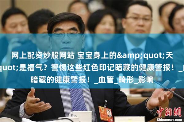 网上配资炒股网站 宝宝身上的&quot;天使之吻&quot;是福气？警惕这些红色印记暗藏的健康警报！_血管_畸形_影响